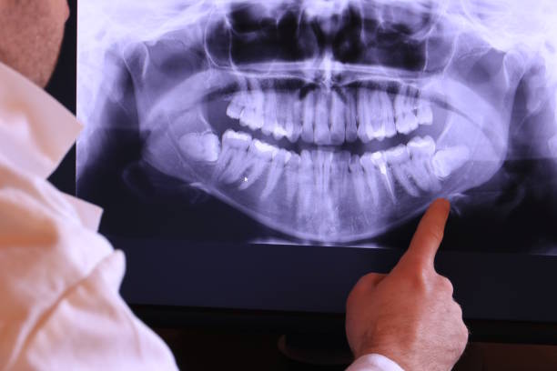 Best Emergency Treatment for Oral Infections in Lake Monticello, VA